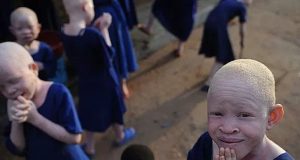 Malawi: Government Offers $7,000 Reward To Stop Albino Killings