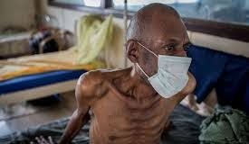 Tarin-Fuka: Akalla Mutane 18 Ke Mutuwa Kowace Sa’a A Fadin Nijeriya – Kwararru