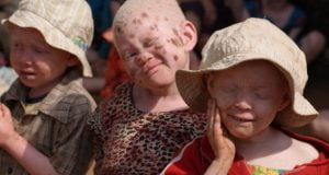 Malawi: Government Launches Inquiry Into Albino Killings