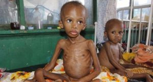 Malnutrition: 2.5m Nigerian Children Stunted 2.5m Children Suffering Acute Malnutrition In Nigeria – UNICEF