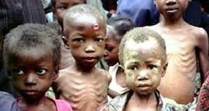 Malnutrition: FG Spends N1.8bn On Prevention, Treatment In 18 States
