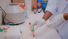 Centre Set To Validate Capacity To Test For Coronavirus At LUTH