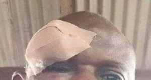 Lockdown: PHCN Official Attacked While Distributing Bills