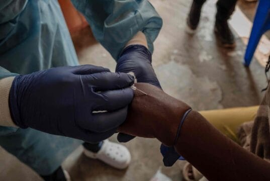 MPOX: Cross River, Lagos Lead As Disease Spreads To 63 LGS. dsfgdfgfgfghghg 1723887199